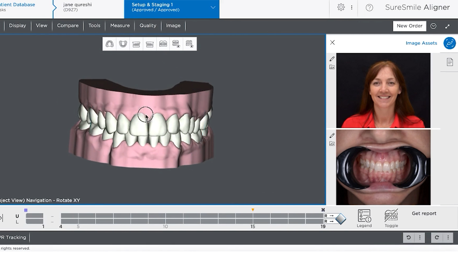 Clear Aligners Online Course (Open Source) IAS Elearning