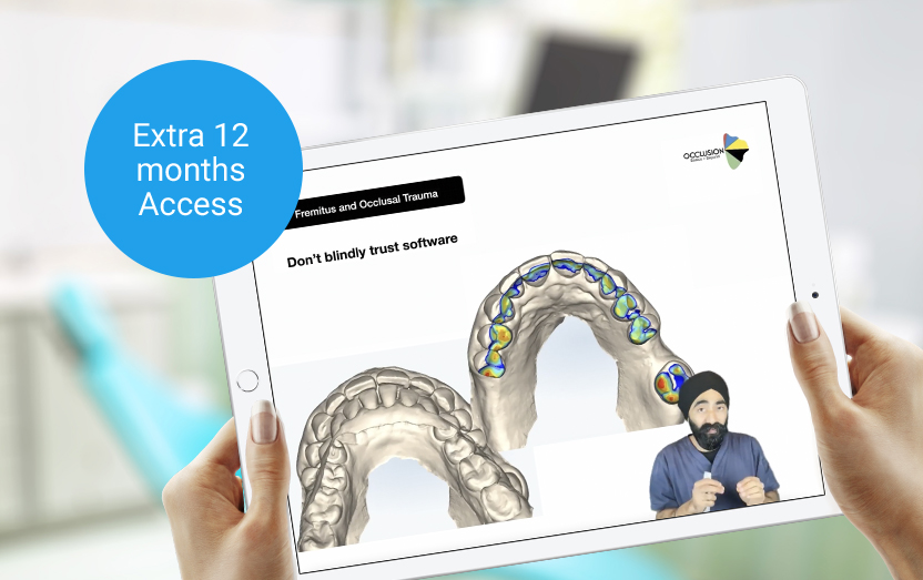 An Extra 12 Months Access To The Course